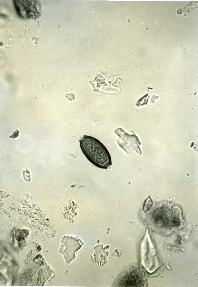 Trichuris trichiura